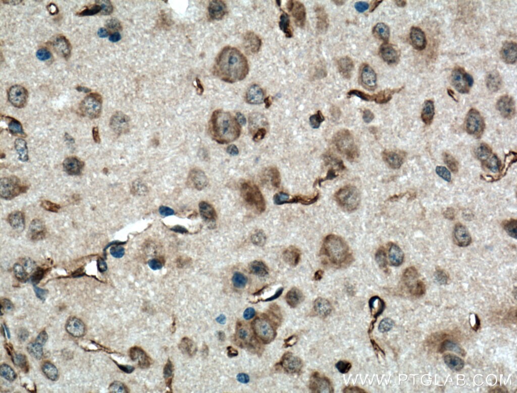 IHC staining of mouse brain using 22265-1-AP