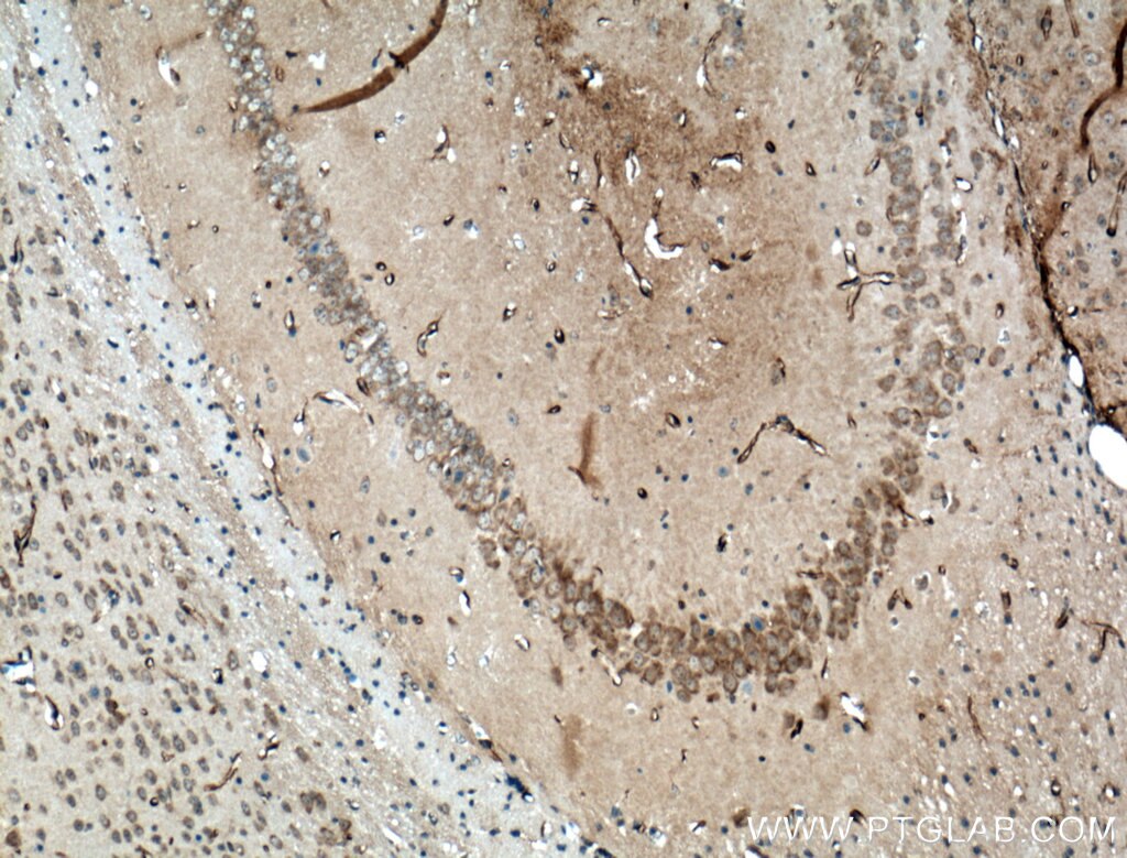 Immunohistochemistry (IHC) staining of mouse brain tissue using SACS Polyclonal antibody (22265-1-AP)