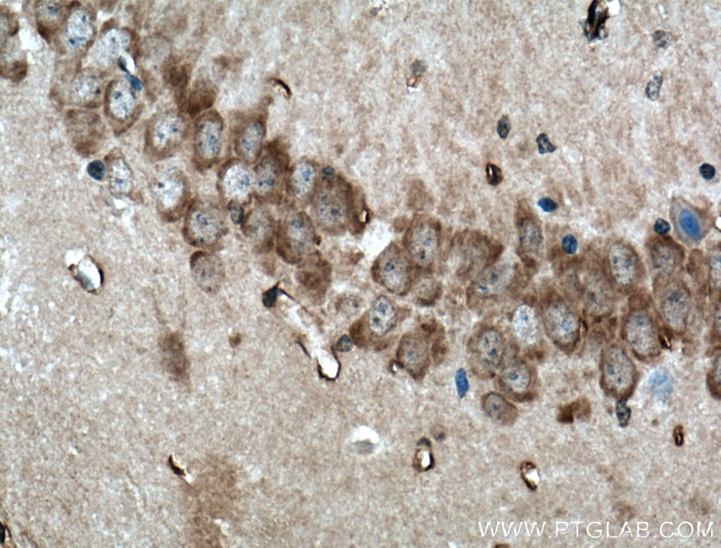 Immunohistochemistry (IHC) staining of mouse brain tissue using SACS Polyclonal antibody (22265-1-AP)