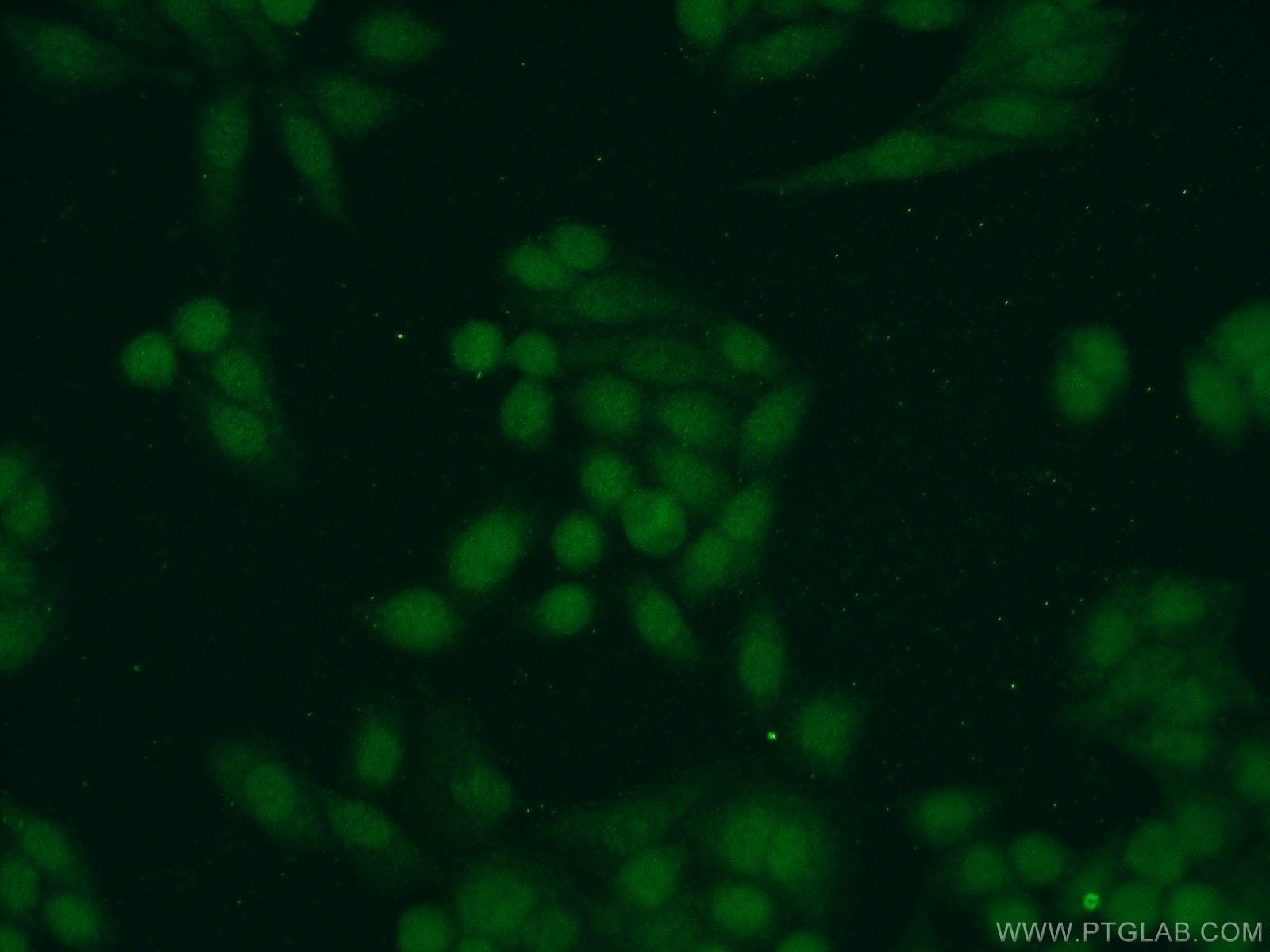 Immunofluorescence (IF) / fluorescent staining of HeLa cells using SAE1 Polyclonal antibody (10229-1-AP)