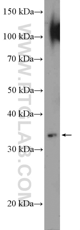 Western Blot (WB) analysis of HEK-293 cells using SAE1 Polyclonal antibody (10229-1-AP)