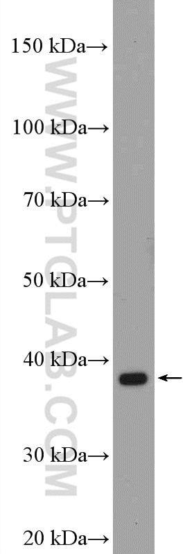 Western Blot (WB) analysis of A549 cells using SAE1 Polyclonal antibody (10229-1-AP)