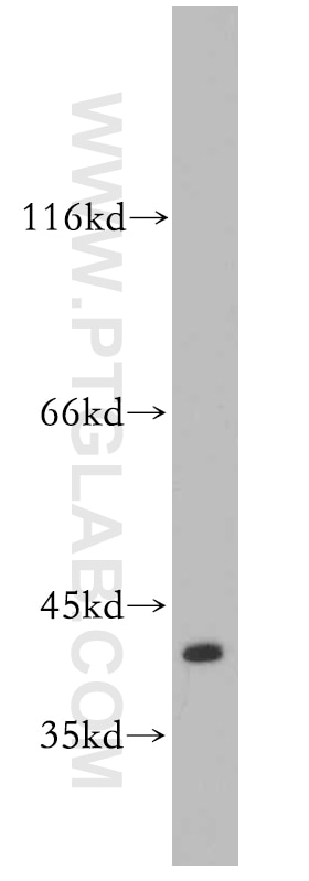 Western Blot (WB) analysis of A431 cells using SAE1 Polyclonal antibody (10229-1-AP)