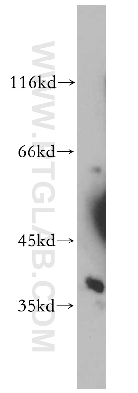 Western Blot (WB) analysis of HeLa cells using SAE1 Polyclonal antibody (10229-1-AP)