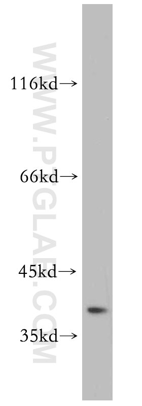 Western Blot (WB) analysis of COLO 320 cells using SAE1 Polyclonal antibody (10229-1-AP)