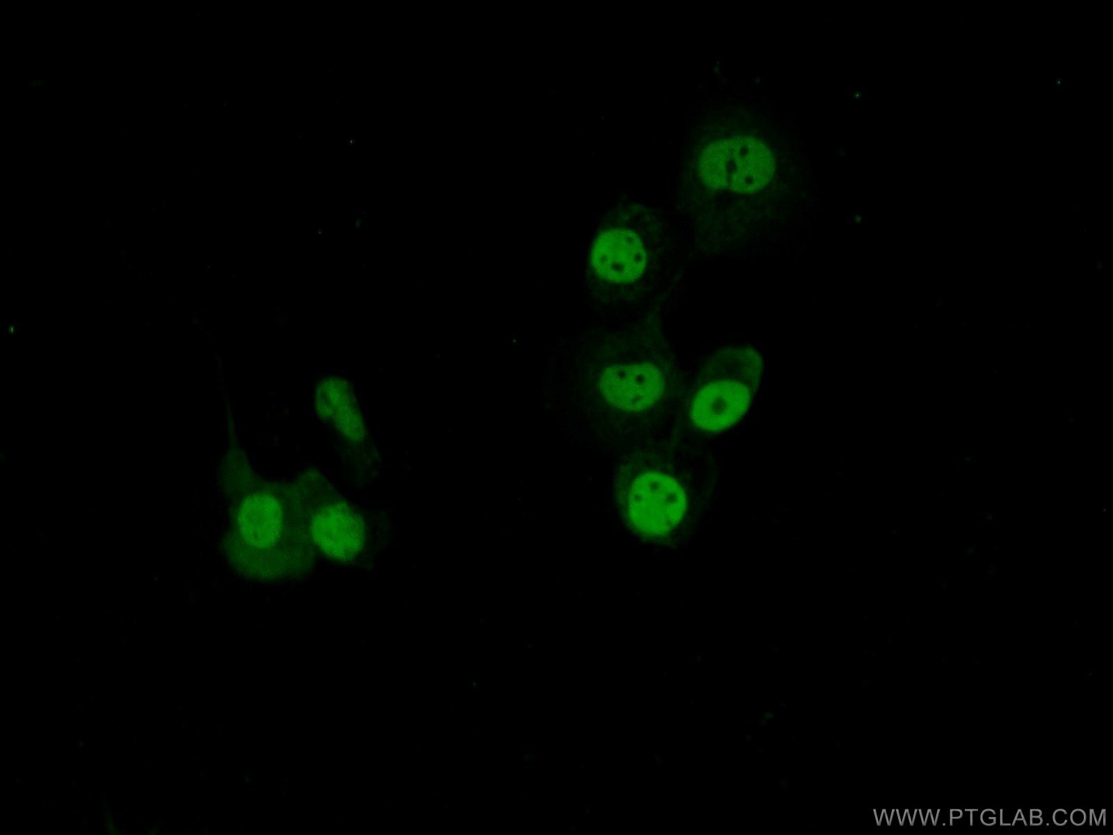 Immunofluorescence (IF) / fluorescent staining of A431 cells using SAFB Polyclonal antibody (21857-1-AP)
