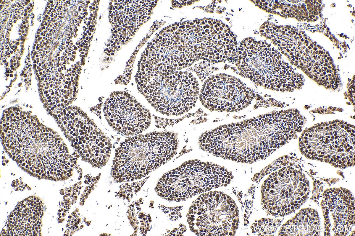 Immunohistochemistry (IHC) staining of mouse testis tissue using SAFB Polyclonal antibody (21857-1-AP)