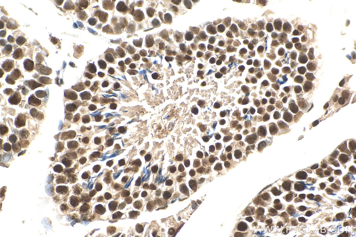 Immunohistochemistry (IHC) staining of mouse testis tissue using SAFB Polyclonal antibody (21857-1-AP)