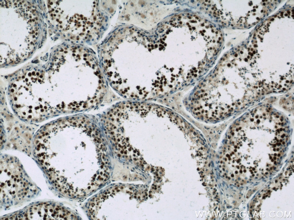 Immunohistochemistry (IHC) staining of human testis tissue using SAFB Polyclonal antibody (21857-1-AP)
