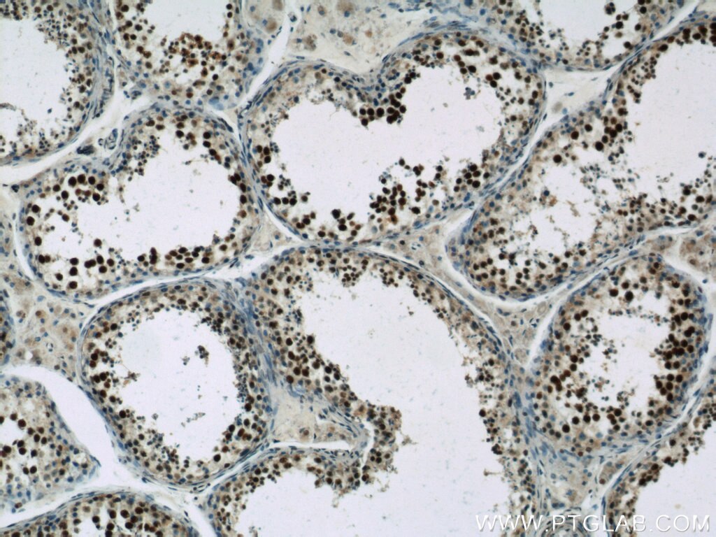 IHC staining of human testis using 21857-1-AP