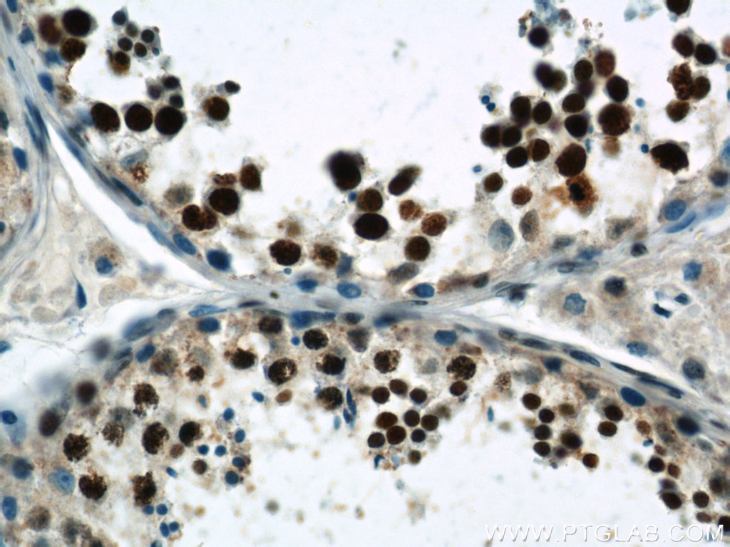 IHC staining of human testis using 21857-1-AP