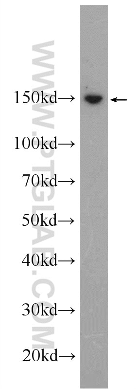 Western Blot (WB) analysis of MCF-7 cells using SAFB Polyclonal antibody (21857-1-AP)