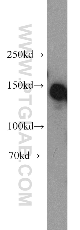 Western Blot (WB) analysis of HeLa cells using SAFB Polyclonal antibody (21857-1-AP)
