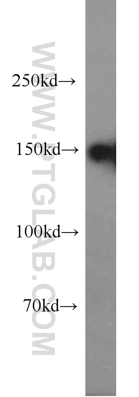 Western Blot (WB) analysis of HepG2 cells using SAFB Polyclonal antibody (21857-1-AP)