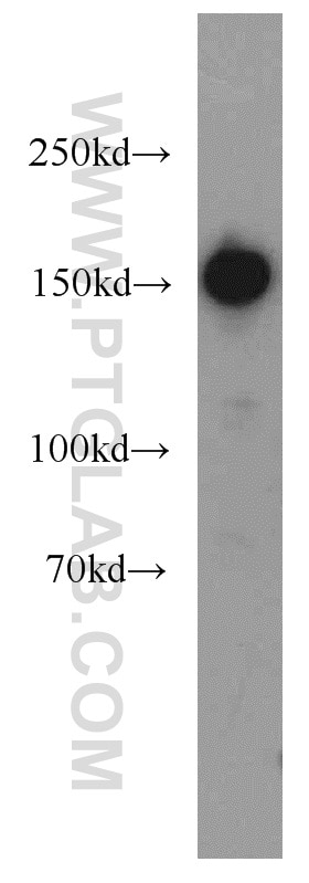 Western Blot (WB) analysis of MCF-7 cells using SAFB Polyclonal antibody (21857-1-AP)