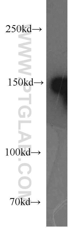 Western Blot (WB) analysis of A431 cells using SAFB Polyclonal antibody (21857-1-AP)