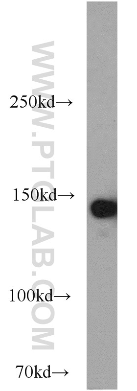 Western Blot (WB) analysis of HeLa cells using SAFB Polyclonal antibody (21857-1-AP)