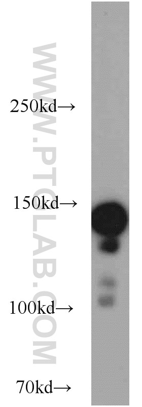 Western Blot (WB) analysis of HeLa cells using SAFB Polyclonal antibody (21857-1-AP)