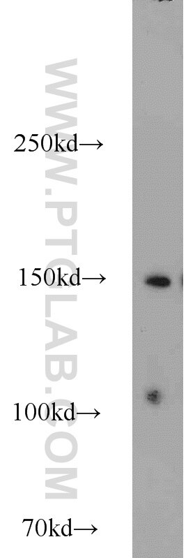 Western Blot (WB) analysis of MCF-7 cells using SAFB Polyclonal antibody (21857-1-AP)