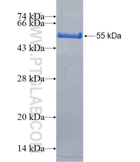 SAFB fusion protein Ag16451 SDS-PAGE