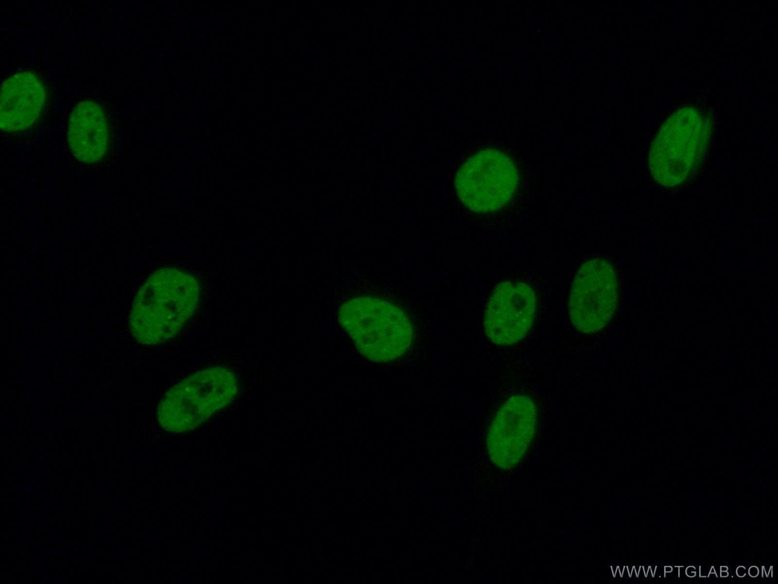 Immunofluorescence (IF) / fluorescent staining of U2OS cells using SAFB2 Polyclonal antibody (11642-1-AP)