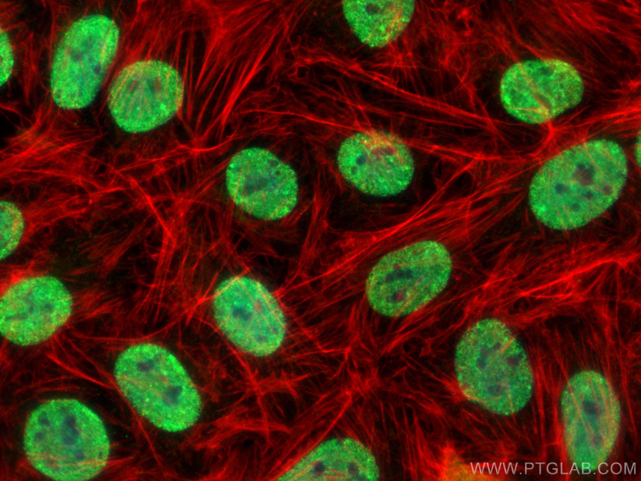 Immunofluorescence (IF) / fluorescent staining of U2OS cells using SAFB2 Polyclonal antibody (11642-1-AP)