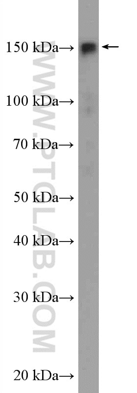 Western Blot (WB) analysis of MCF-7 cells using SAFB2 Polyclonal antibody (11642-1-AP)