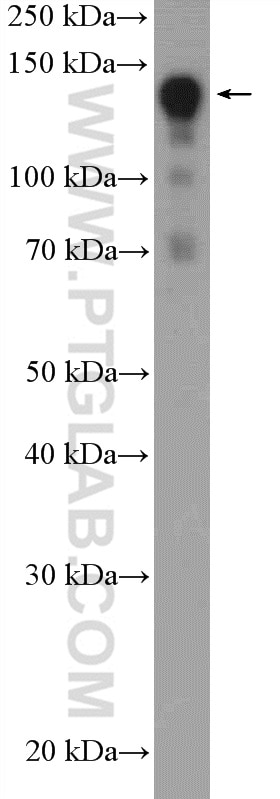 Western Blot (WB) analysis of rat pancreas tissue using SAFB2 Polyclonal antibody (11642-1-AP)