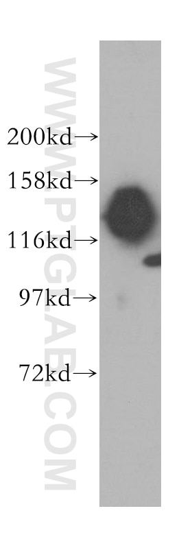 Western Blot (WB) analysis of HeLa cells using SAFB2 Polyclonal antibody (11642-1-AP)