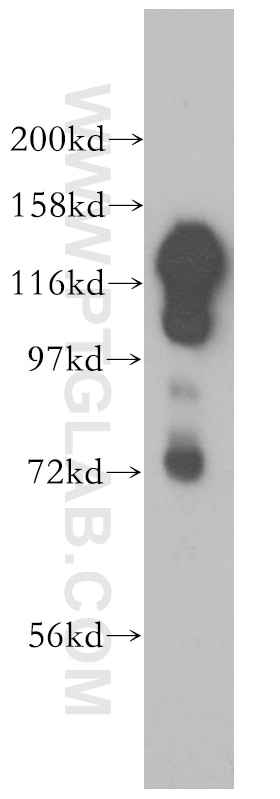 Western Blot (WB) analysis of MCF-7 cells using SAFB2 Polyclonal antibody (11642-1-AP)