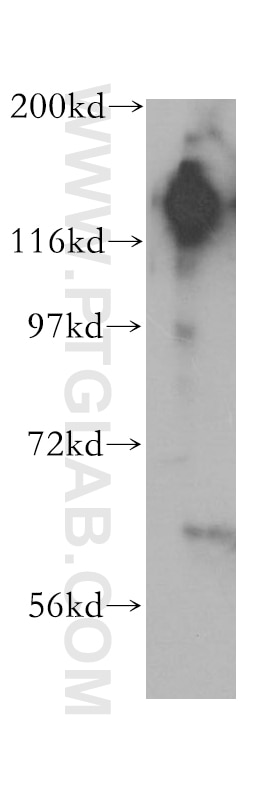 Western Blot (WB) analysis of BxPC-3 cells using SAFB2 Polyclonal antibody (11642-1-AP)