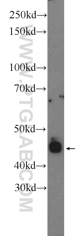 Retinal S antigen