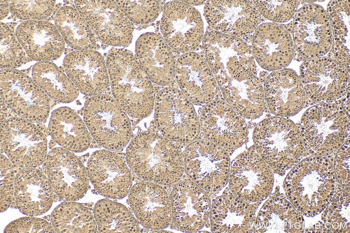 Immunohistochemistry (IHC) staining of mouse testis tissue using SAGE1 Polyclonal antibody (30914-1-AP)