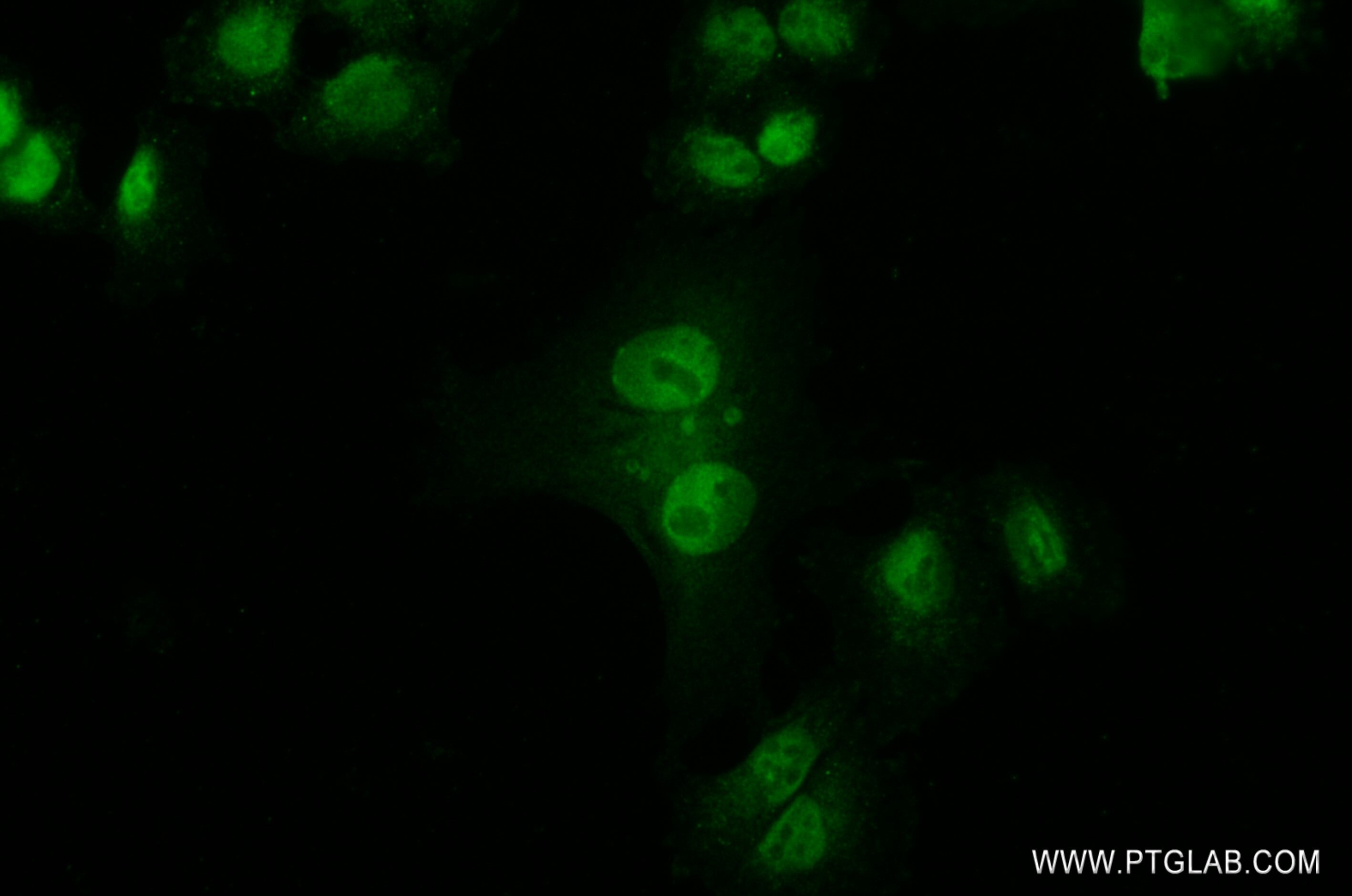 Immunofluorescence (IF) / fluorescent staining of MDA-MB-453 cells using SAGE1 Recombinant antibody (82876-1-RR)