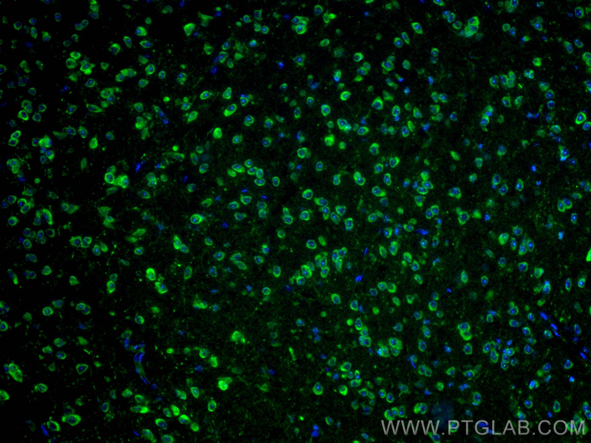 Immunofluorescence (IF) / fluorescent staining of mouse brain tissue using SALL1 Polyclonal antibody (27761-1-AP)