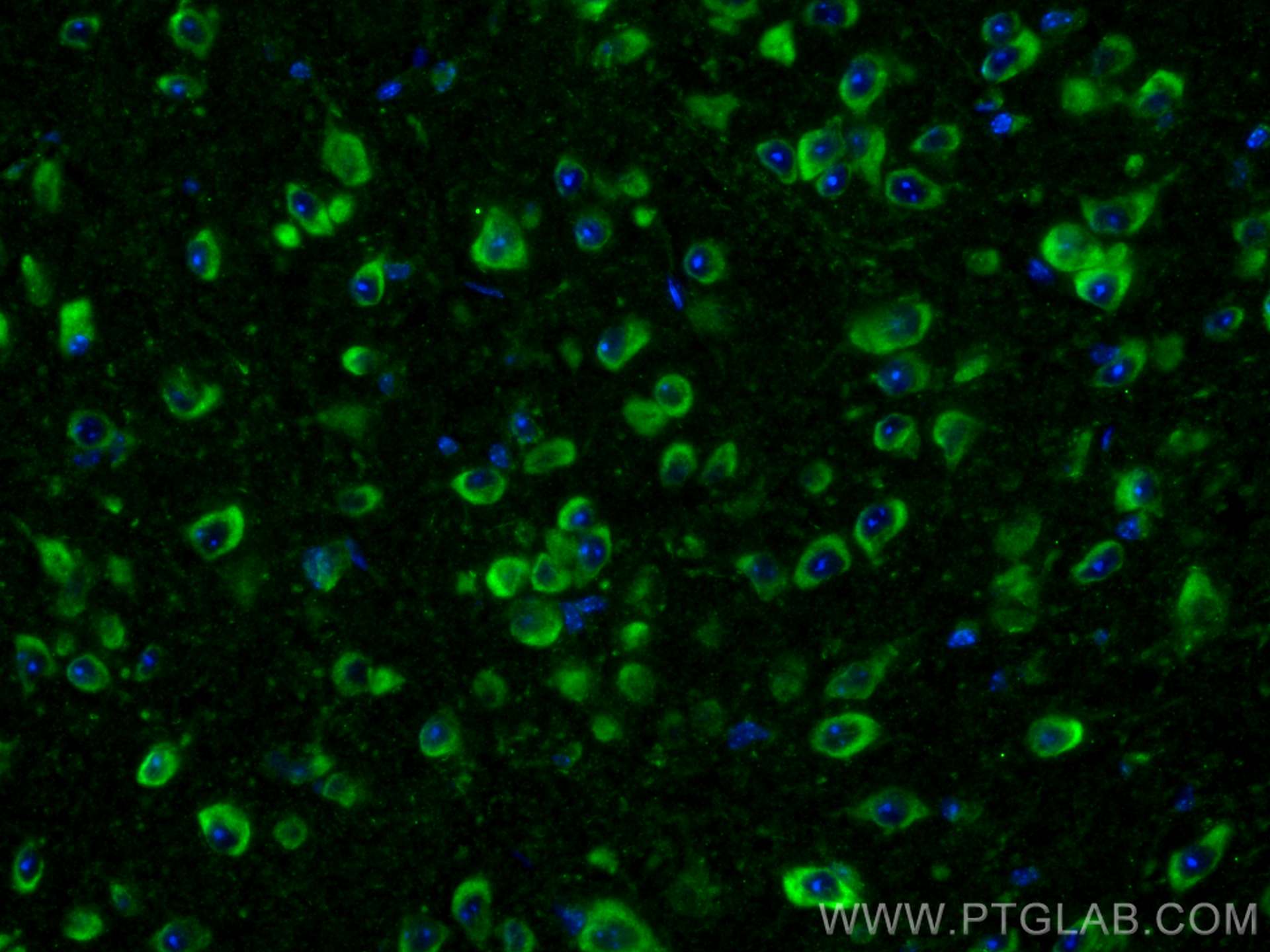 Immunofluorescence (IF) / fluorescent staining of mouse brain tissue using SALL1 Polyclonal antibody (27761-1-AP)