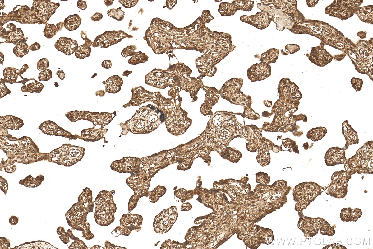 Immunohistochemistry (IHC) staining of human placenta tissue using SALL1 Polyclonal antibody (27761-1-AP)