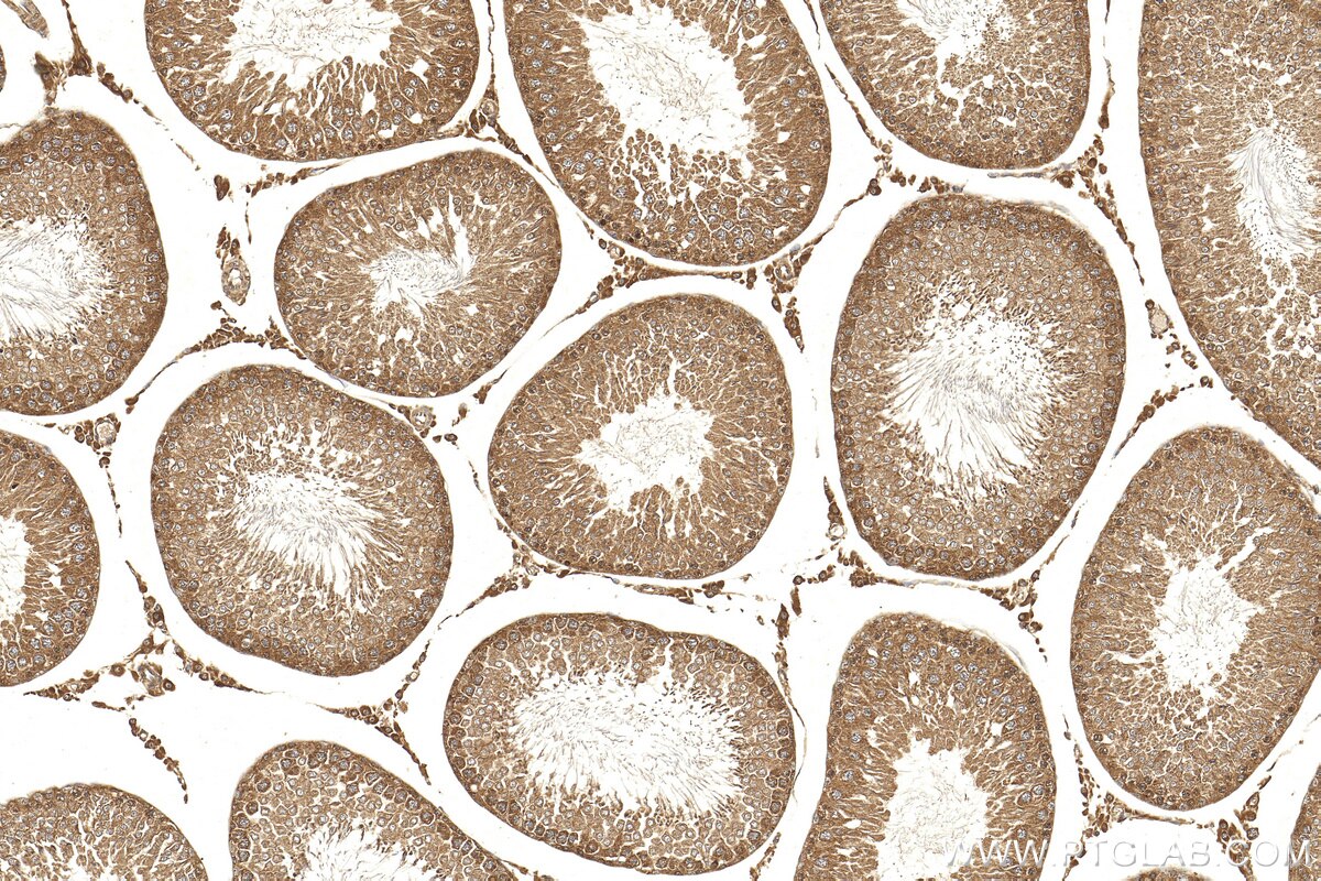 Immunohistochemistry (IHC) staining of rat testis tissue using SALL1 Polyclonal antibody (27761-1-AP)