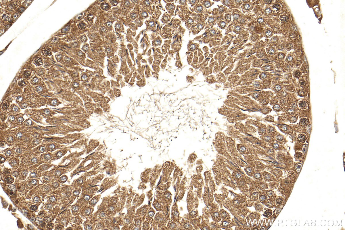 Immunohistochemistry (IHC) staining of rat testis tissue using SALL1 Polyclonal antibody (27761-1-AP)