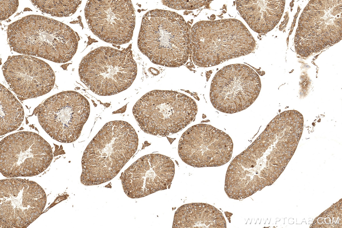 Immunohistochemistry (IHC) staining of mouse testis tissue using SALL1 Polyclonal antibody (27761-1-AP)