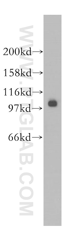 Western Blot (WB) analysis of HEK-293 cells using SALL2 Polyclonal antibody (12679-1-AP)