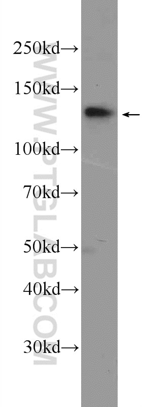 Western Blot (WB) analysis of Jurkat cells using SALL2 Polyclonal antibody (23114-1-AP)