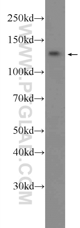 Western Blot (WB) analysis of HEK-293 cells using SALL2 Polyclonal antibody (23114-1-AP)