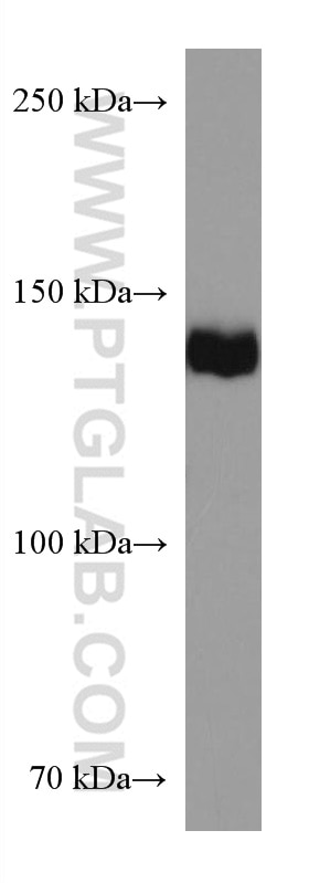 Western Blot (WB) analysis of NCCIT cells using SALL2 Monoclonal antibody (67522-1-Ig)