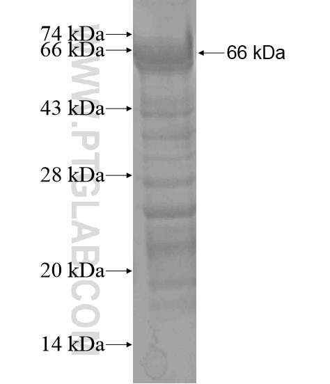SALL2 fusion protein Ag19427 SDS-PAGE