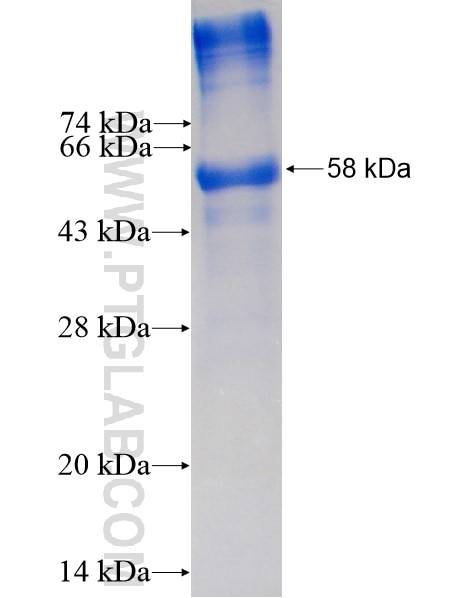 SALL2 fusion protein Ag3367 SDS-PAGE