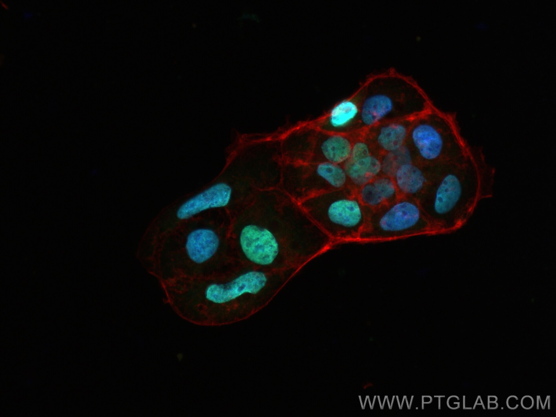 Immunofluorescence (IF) / fluorescent staining of Caco-2 cells using SALL4 Polyclonal antibody (24500-1-AP)