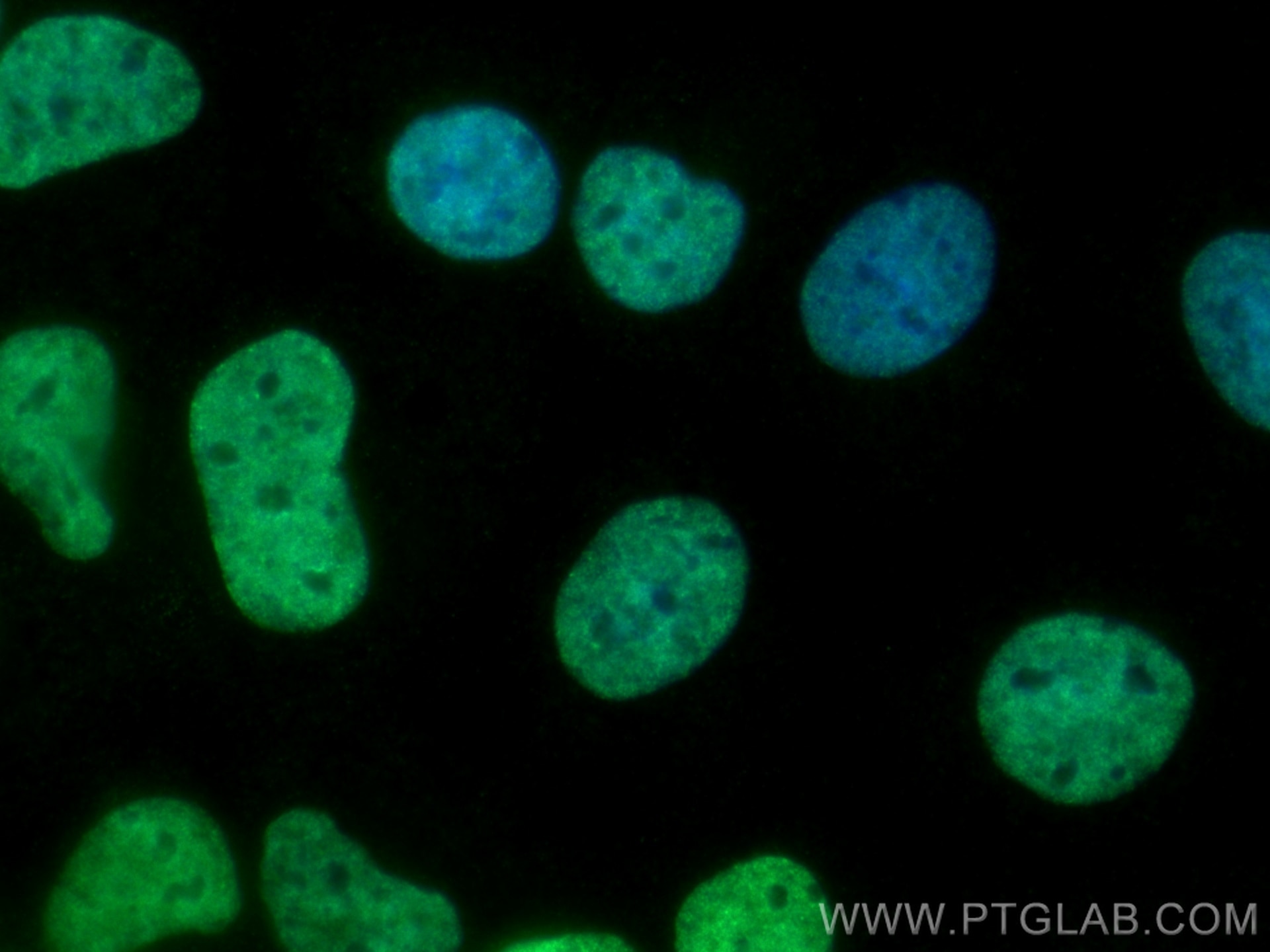 Immunofluorescence (IF) / fluorescent staining of Caco-2 cells using SALL4 Polyclonal antibody (24500-1-AP)