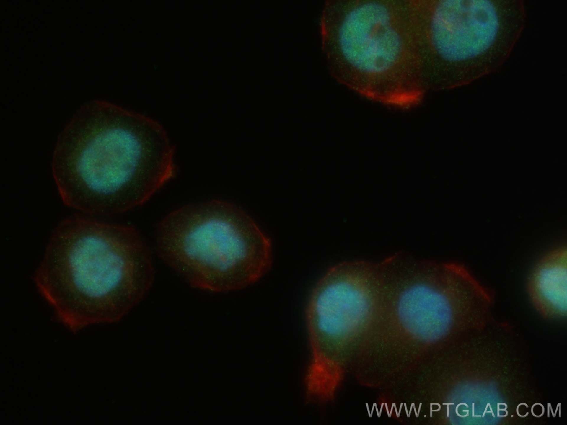 Immunofluorescence (IF) / fluorescent staining of NCCIT cells using SALL4 Polyclonal antibody (24500-1-AP)