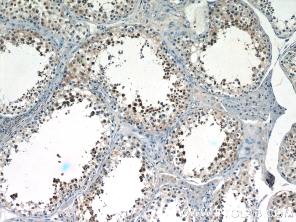 Immunohistochemistry (IHC) staining of human testis tissue using SALL4 Polyclonal antibody (24500-1-AP)